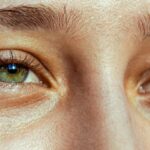 5 Early Signs of Proptosis That a Quiz Can Help Identify: A Clear Guide to Spotting Symptoms Early