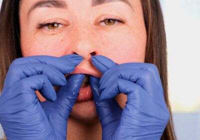 Cosmetic surgery