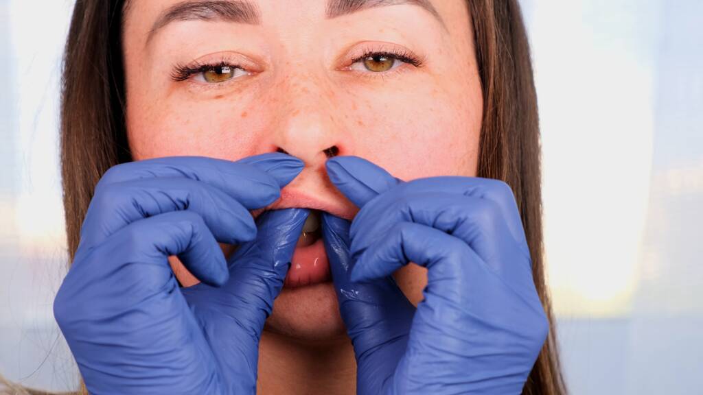 Cosmetic surgery
