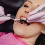 How Ceramic Teeth Caps Gave Me My Smile Back A Personal Journey to Confidence and Comfort