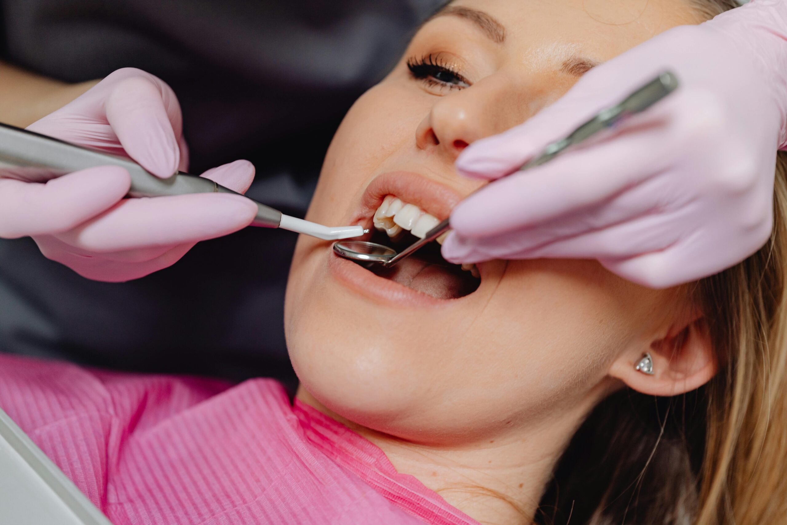 How Ceramic Teeth Caps Gave Me My Smile Back A Personal Journey to Confidence and Comfort