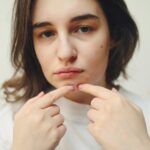 I Tried Everything for My Acne Here’s What Helped