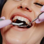 How to Keep Your Teeth Healthy Long Term