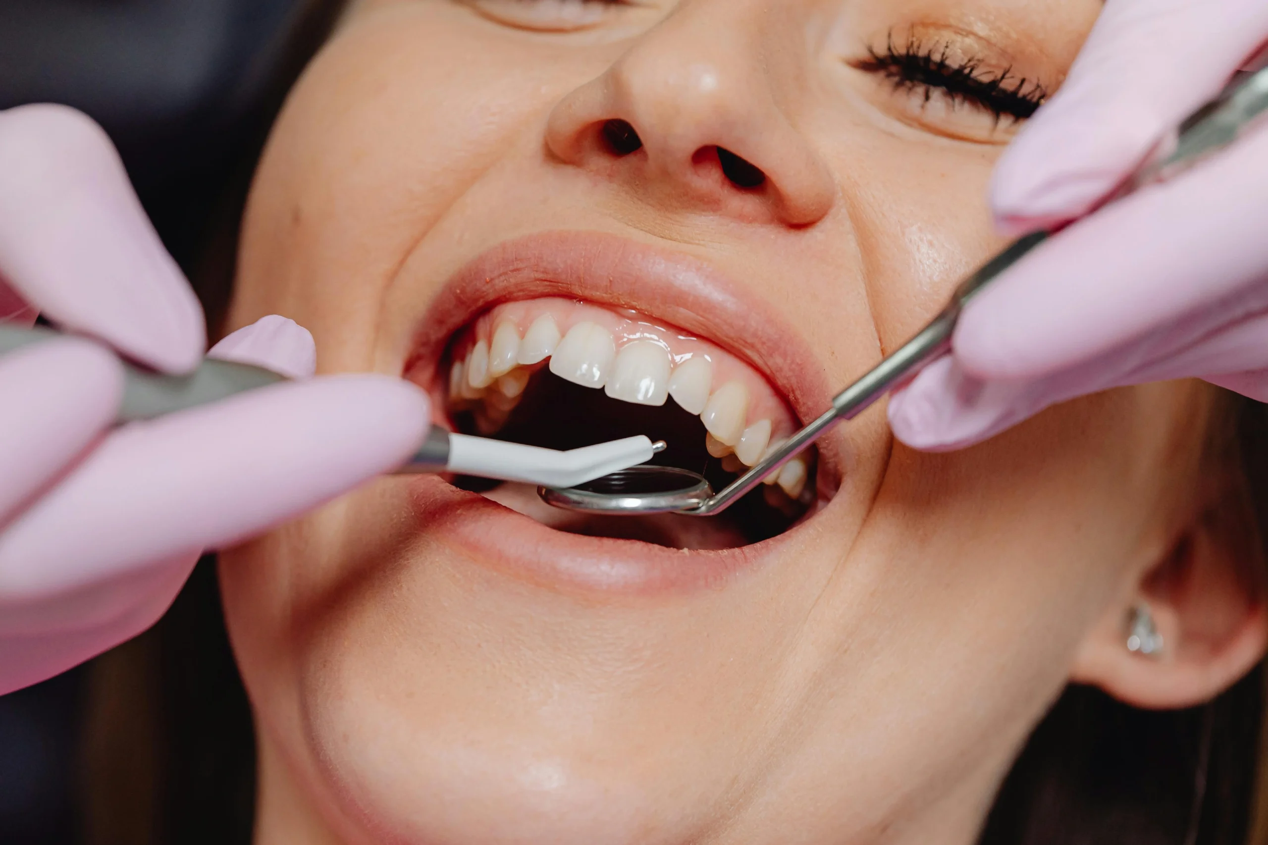How to Keep Your Teeth Healthy Long Term