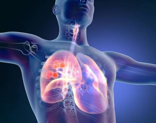 Clinical Perspectives on Patient Selection for First-Line HER2+ GEA treatment